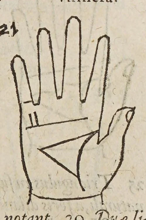An illustration from Opus mathematicum octo libros complectens, : innumeris propemodum figuris idealibus manuum et physiognomiae, aliisque adornatum, quorum sex priores libri absolutissimae cheiromantiae theoricam, praxim, doctrinam, artem, & experientiam verissimam continent. Septimus physiognomiae dispositionem, hominʹumque omnium qualitates & complexiones. Octauus periaxiomata de faciebus signorum, & quid sol in vnaquaque domo existens, natis polliceatur. Remedia quoque omnium ægritudinum complectitur. Et naturalem astrologiam atq[ue] effectus lunae quoad diuersas ægritudines. Item isagogen astrologiæ iudiciariae, & totius diuinatricis artis encomia. Omnibus matheseos, cheiromantiae, philosophiae, & medicinæ studiosis vtiles ac necessarij., 1583, leaf 307