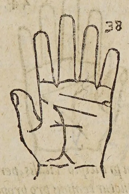 An illustration from Opus mathematicum octo libros complectens, : innumeris propemodum figuris idealibus manuum et physiognomiae, aliisque adornatum, quorum sex priores libri absolutissimae cheiromantiae theoricam, praxim, doctrinam, artem, & experientiam verissimam continent. Septimus physiognomiae dispositionem, hominʹumque omnium qualitates & complexiones. Octauus periaxiomata de faciebus signorum, & quid sol in vnaquaque domo existens, natis polliceatur. Remedia quoque omnium ægritudinum complectitur. Et naturalem astrologiam atq[ue] effectus lunae quoad diuersas ægritudines. Item isagogen astrologiæ iudiciariae, & totius diuinatricis artis encomia. Omnibus matheseos, cheiromantiae, philosophiae, & medicinæ studiosis vtiles ac necessarij., 1583, leaf 79