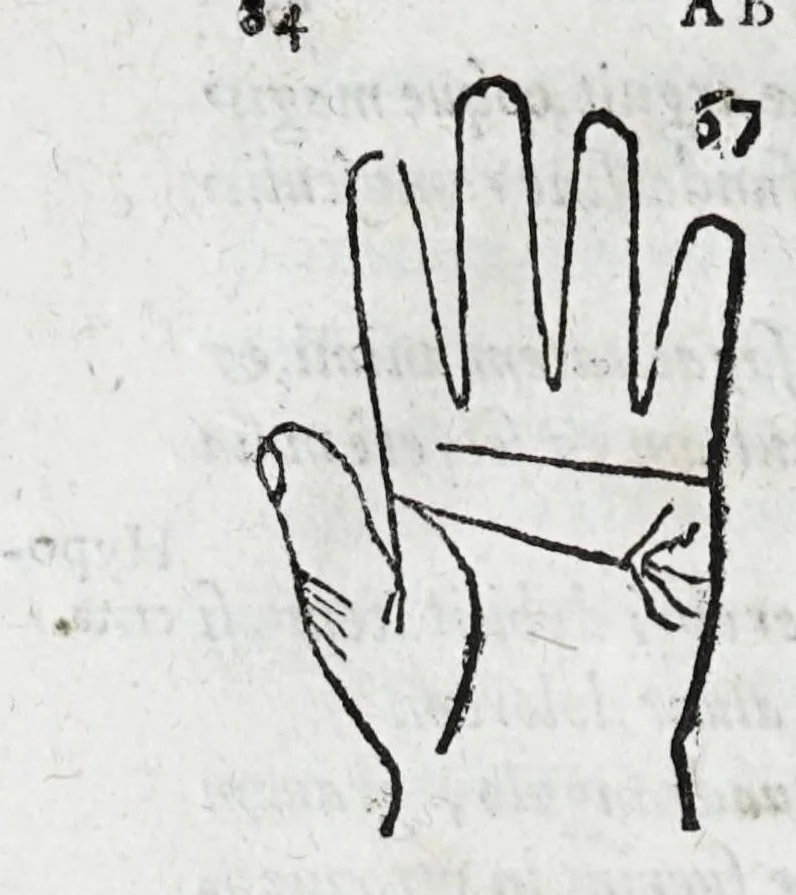An illustration from Opvs mathematicvm octo libros complectens : innvmeris propemodvm figvris idealibvs manvvm et physiognomiae, aliisqve adornatvm, qvorvm sex priores libri absolutissimae cheiromantiae theoricam, praxim, doctrinam, artem, & experientiam verissimam continent : septimus physiognomiae dispositionem, hominumque omnium qualitates & complexiones : octauus periaxiomata de faciebus signorum, & quid sol in vnaquaque domo existens, natis polliceatur : remedia quoq; omnium aegritudinum complectitur : et naturalem astrologiam atq; effectus lunae quoad diuersas aegritudines : item isagogen astrologiae iudiciariae, & totius diuinatricis artis encomia ..., 1562, leaf 100