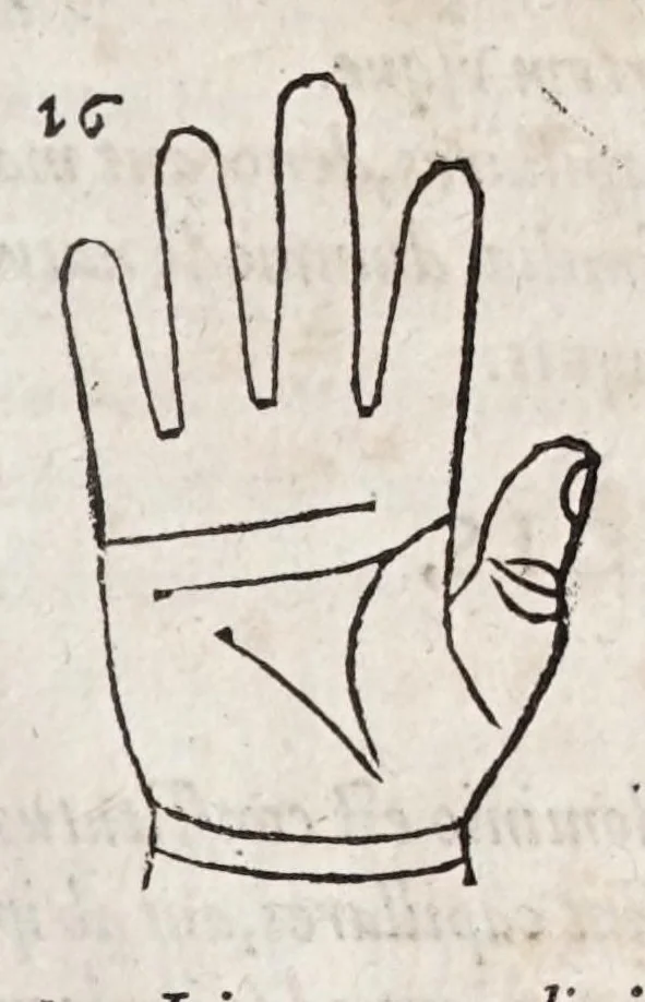 An illustration from Opvs mathematicvm octo libros complectens : innvmeris propemodvm figvris idealibvs manvvm et physiognomiae, aliisqve adornatvm, qvorvm sex priores libri absolutissimae cheiromantiae theoricam, praxim, doctrinam, artem, & experientiam verissimam continent : septimus physiognomiae dispositionem, hominumque omnium qualitates & complexiones : octauus periaxiomata de faciebus signorum, & quid sol in vnaquaque domo existens, natis polliceatur : remedia quoq; omnium aegritudinum complectitur : et naturalem astrologiam atq; effectus lunae quoad diuersas aegritudines : item isagogen astrologiae iudiciariae, & totius diuinatricis artis encomia ..., 1562, leaf 151