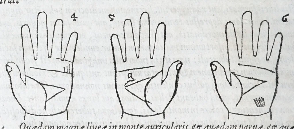 An illustration from Opvs mathematicvm octo libros complectens : innvmeris propemodvm figvris idealibvs manvvm et physiognomiae, aliisqve adornatvm, qvorvm sex priores libri absolutissimae cheiromantiae theoricam, praxim, doctrinam, artem, & experientiam verissimam continent : septimus physiognomiae dispositionem, hominumque omnium qualitates & complexiones : octauus periaxiomata de faciebus signorum, & quid sol in vnaquaque domo existens, natis polliceatur : remedia quoq; omnium aegritudinum complectitur : et naturalem astrologiam atq; effectus lunae quoad diuersas aegritudines : item isagogen astrologiae iudiciariae, & totius diuinatricis artis encomia ..., 1562, leaf 248