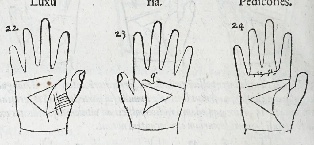 An illustration from Opvs mathematicvm octo libros complectens : innvmeris propemodvm figvris idealibvs manvvm et physiognomiae, aliisqve adornatvm, qvorvm sex priores libri absolutissimae cheiromantiae theoricam, praxim, doctrinam, artem, & experientiam verissimam continent : septimus physiognomiae dispositionem, hominumque omnium qualitates & complexiones : octauus periaxiomata de faciebus signorum, & quid sol in vnaquaque domo existens, natis polliceatur : remedia quoq; omnium aegritudinum complectitur : et naturalem astrologiam atq; effectus lunae quoad diuersas aegritudines : item isagogen astrologiae iudiciariae, & totius diuinatricis artis encomia ..., 1562, leaf 256