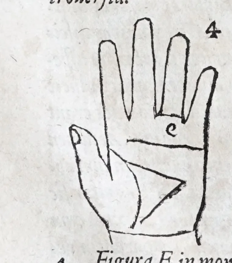 An illustration from Opvs mathematicvm octo libros complectens : innvmeris propemodvm figvris idealibvs manvvm et physiognomiae, aliisqve adornatvm, qvorvm sex priores libri absolutissimae cheiromantiae theoricam, praxim, doctrinam, artem, & experientiam verissimam continent : septimus physiognomiae dispositionem, hominumque omnium qualitates & complexiones : octauus periaxiomata de faciebus signorum, & quid sol in vnaquaque domo existens, natis polliceatur : remedia quoq; omnium aegritudinum complectitur : et naturalem astrologiam atq; effectus lunae quoad diuersas aegritudines : item isagogen astrologiae iudiciariae, & totius diuinatricis artis encomia ..., 1562, leaf 266