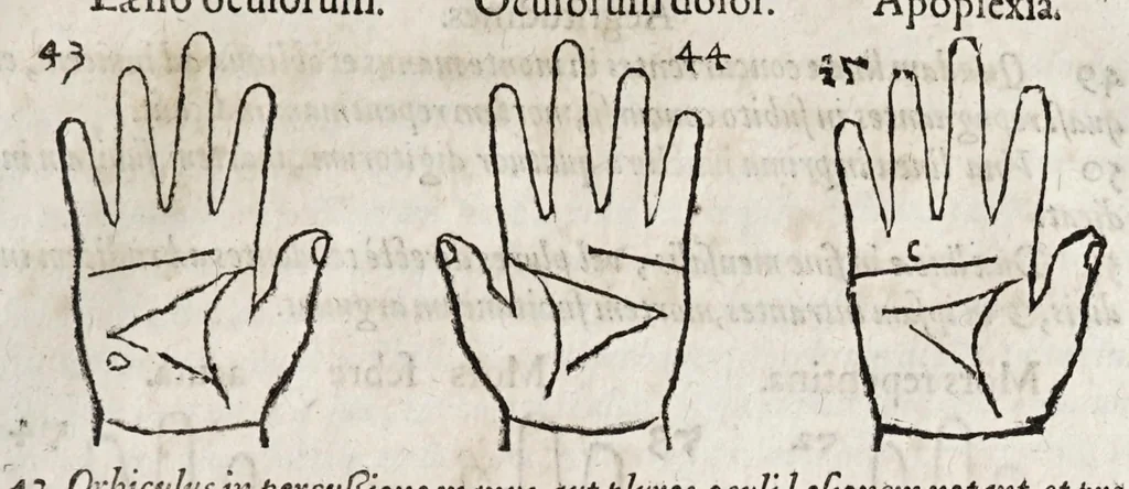 An illustration from Opvs mathematicvm octo libros complectens : innvmeris propemodvm figvris idealibvs manvvm et physiognomiae, aliisqve adornatvm, qvorvm sex priores libri absolutissimae cheiromantiae theoricam, praxim, doctrinam, artem, & experientiam verissimam continent : septimus physiognomiae dispositionem, hominumque omnium qualitates & complexiones : octauus periaxiomata de faciebus signorum, & quid sol in vnaquaque domo existens, natis polliceatur : remedia quoq; omnium aegritudinum complectitur : et naturalem astrologiam atq; effectus lunae quoad diuersas aegritudines : item isagogen astrologiae iudiciariae, & totius diuinatricis artis encomia ..., 1562, leaf 293