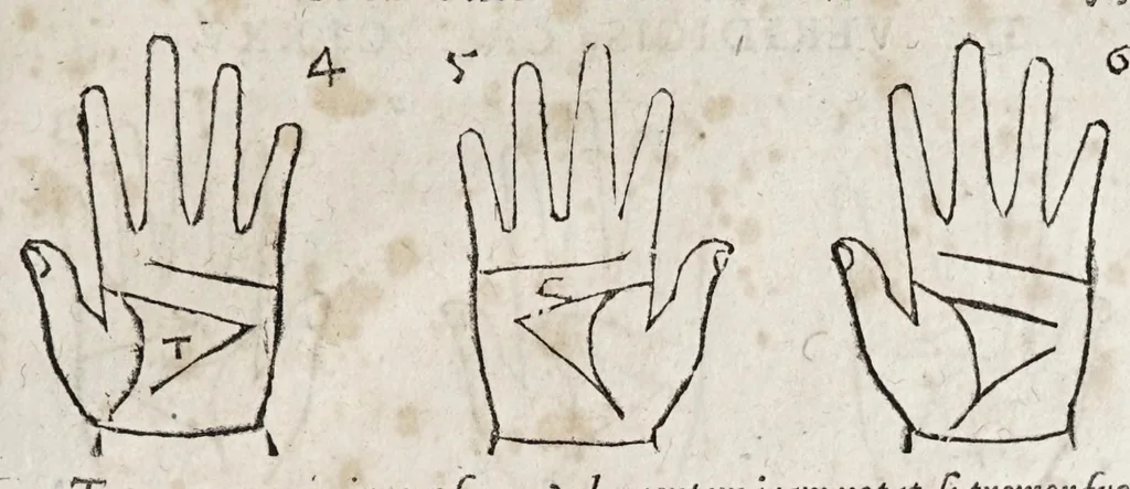 An illustration from Opvs mathematicvm octo libros complectens : innvmeris propemodvm figvris idealibvs manvvm et physiognomiae, aliisqve adornatvm, qvorvm sex priores libri absolutissimae cheiromantiae theoricam, praxim, doctrinam, artem, & experientiam verissimam continent : septimus physiognomiae dispositionem, hominumque omnium qualitates & complexiones : octauus periaxiomata de faciebus signorum, & quid sol in vnaquaque domo existens, natis polliceatur : remedia quoq; omnium aegritudinum complectitur : et naturalem astrologiam atq; effectus lunae quoad diuersas aegritudines : item isagogen astrologiae iudiciariae, & totius diuinatricis artis encomia ..., 1562, leaf 399