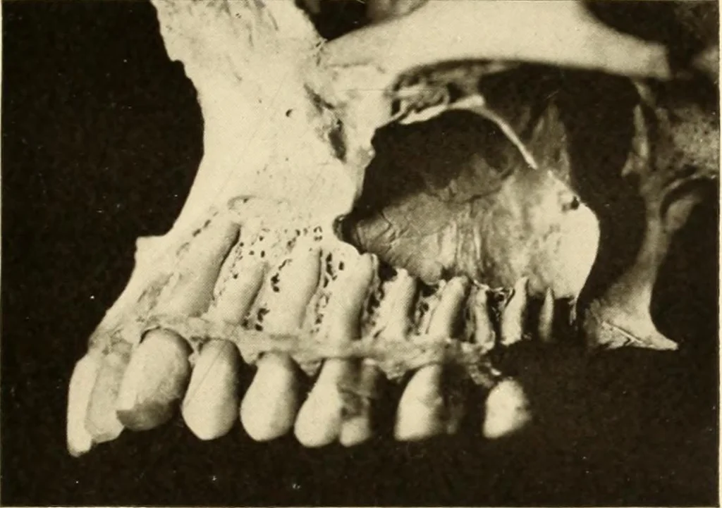 An illustration from Oral Roentgenology : a Roentgen study of the anatomy and pathology of the oral cavity, 1917, leaf 42