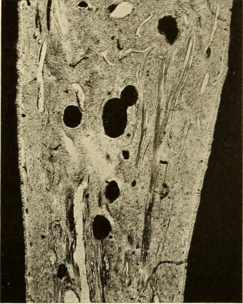 An illustration from Oral Roentgenology : a Roentgen study of the anatomy and pathology of the oral cavity, 1917, leaf 98