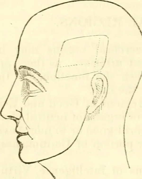 An illustration from Outlines of lectures on the neurological system of anthropology, as discovered, demonstrated and taught in 1841 and 1842, 1854, leaf 181