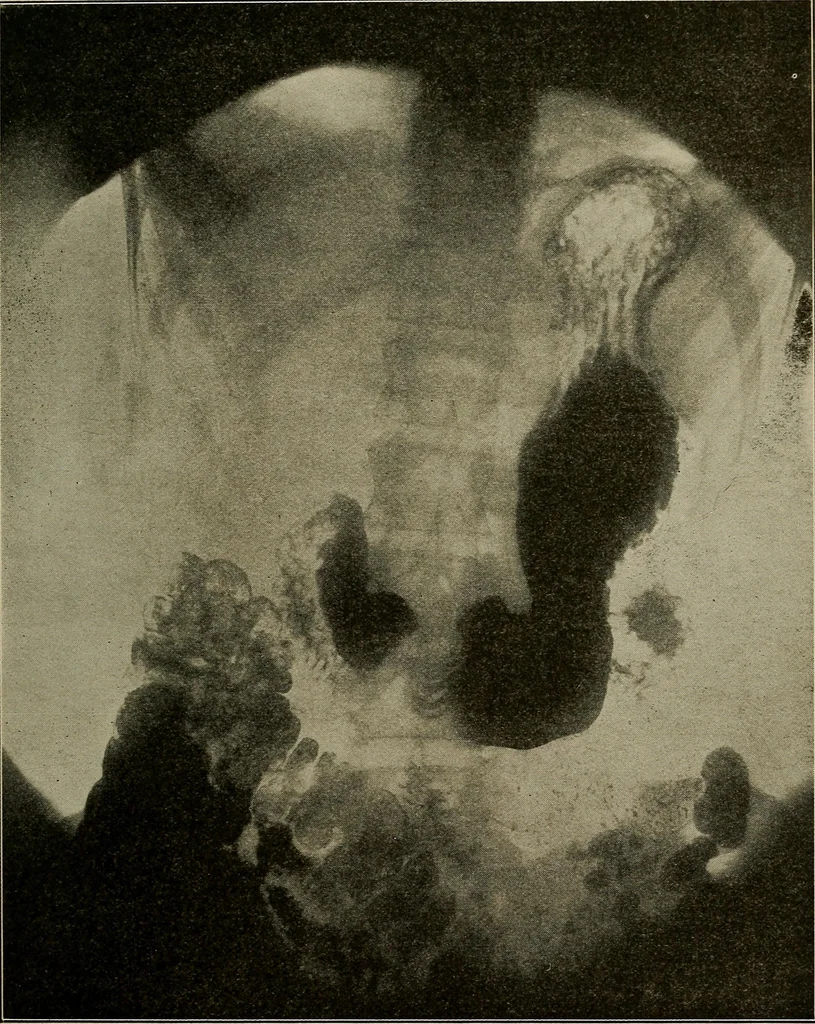 An illustration from Paragon X-ray pointers : a complete textbook on radiography with Paragon X-ray plates, 1915, leaf 40