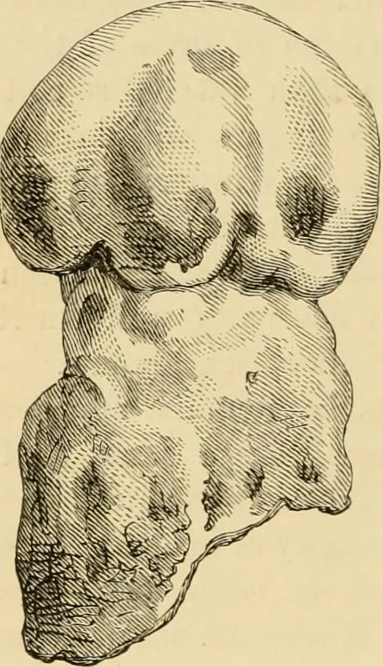 An illustration from The parks and gardens of Paris, considered in relation to the wants of other cities and of the public and private gardens; being notes on a study of Paris gardens, 1878, leaf 561