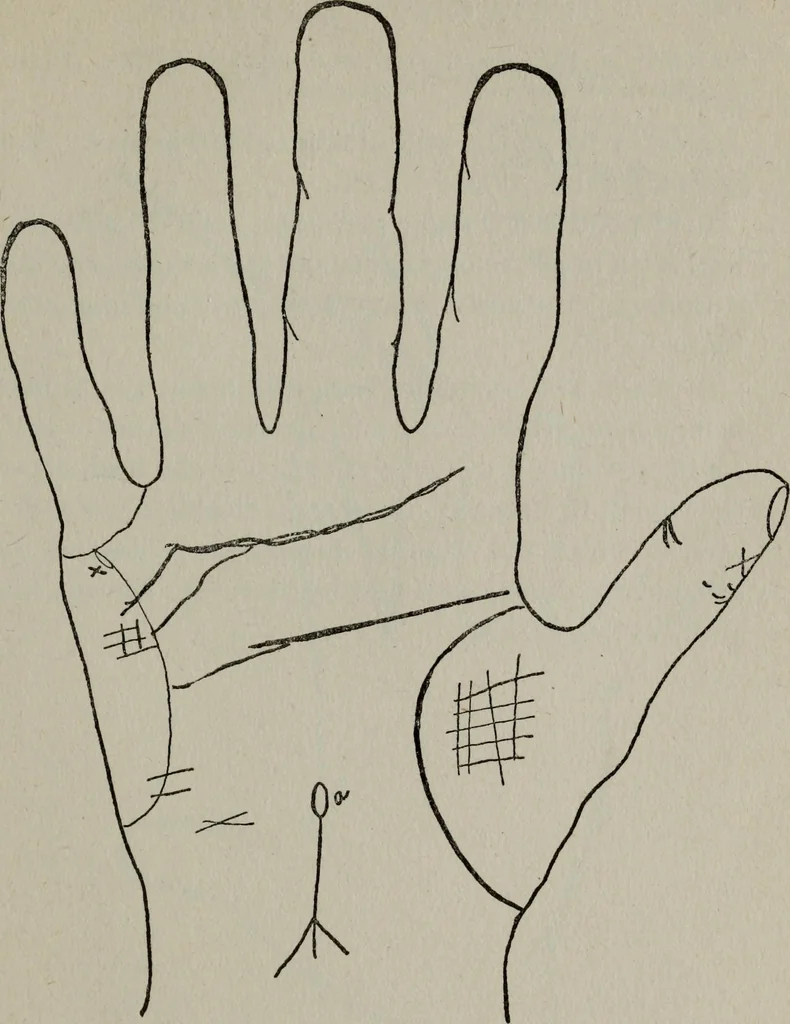 An illustration from Perin's science of palmistry; a complete and authentic treatise, 1902, leaf 190