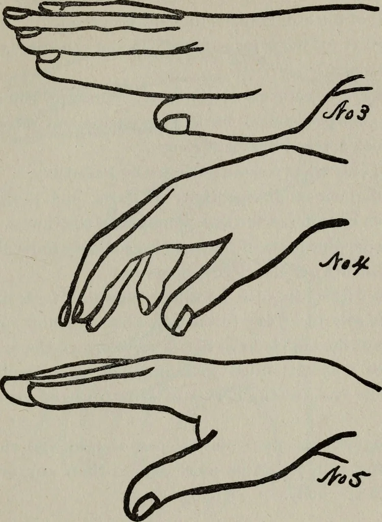 An illustration from Perin's science of palmistry; a complete and authentic treatise, 1902, leaf 194