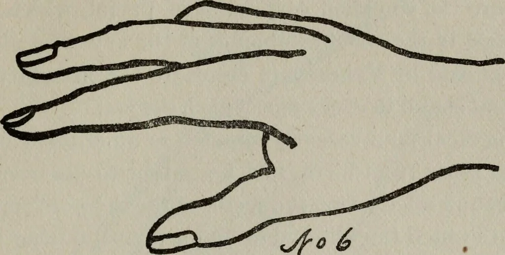 An illustration from Perin's science of palmistry; a complete and authentic treatise, 1902, leaf 196