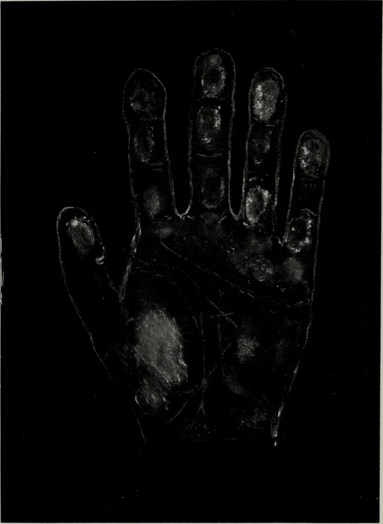 An illustration from Perin's science of palmistry; a complete and authentic treatise, 1902, leaf 228