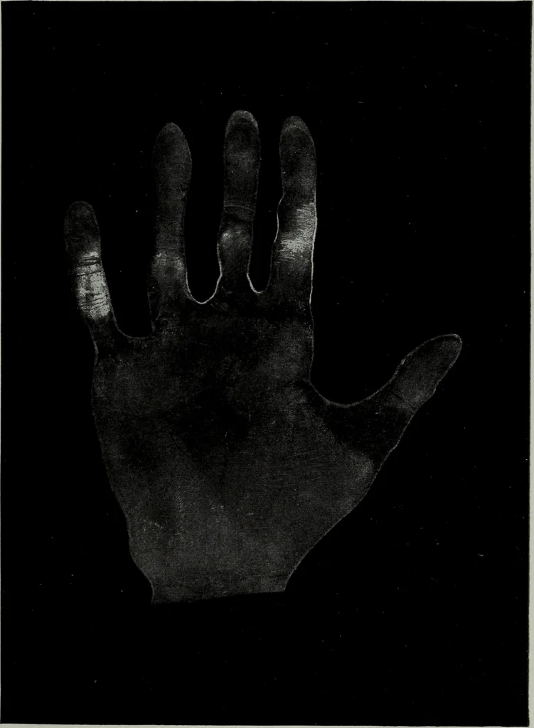 An illustration from Perin's science of palmistry; a complete and authentic treatise, 1902, leaf 232
