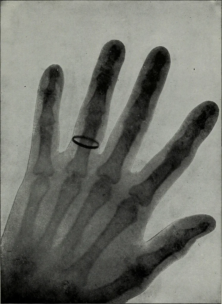 An illustration from Perin's science of palmistry; a complete and authentic treatise, 1902, leaf 236