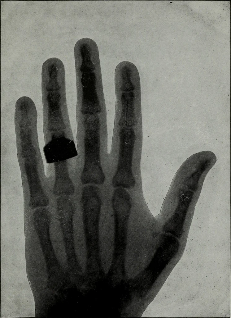 An illustration from Perin's science of palmistry; a complete and authentic treatise, 1902, leaf 240