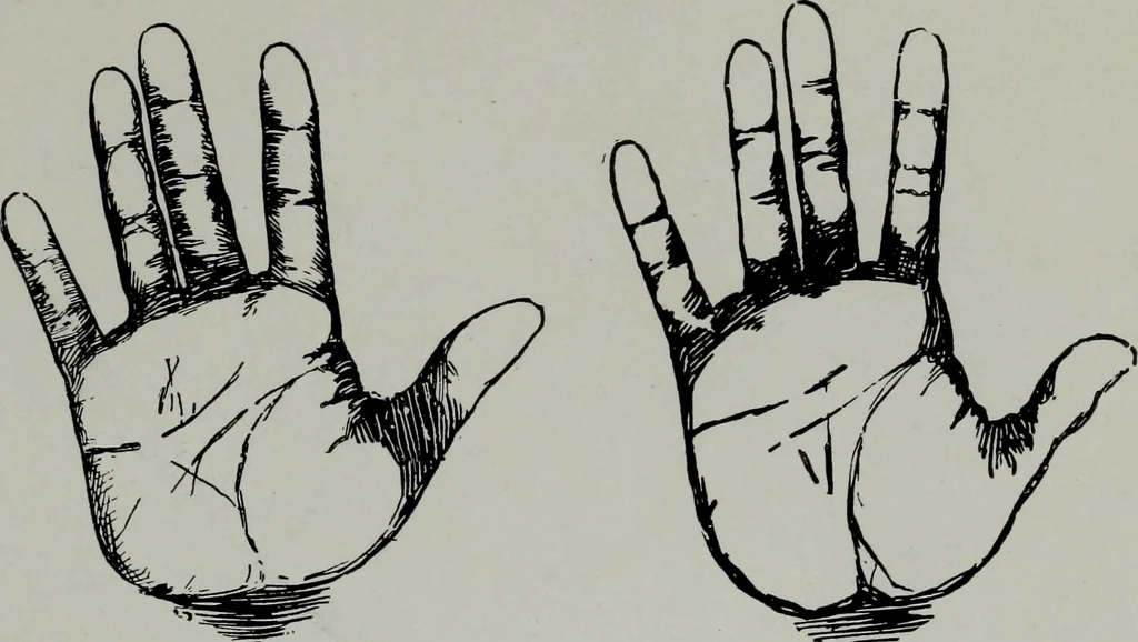 An illustration from Perin's science of palmistry; a complete and authentic treatise, 1902, leaf 244