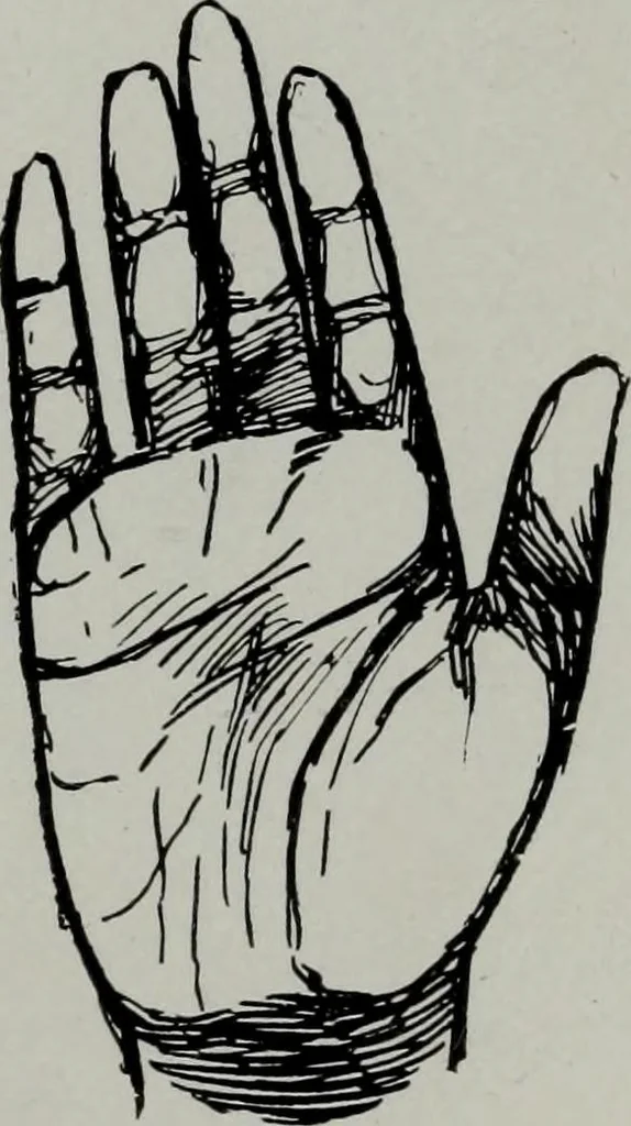 An illustration from Perin's science of palmistry; a complete and authentic treatise, 1902, leaf 244