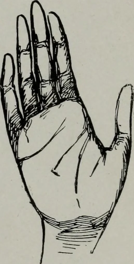 An illustration from Perin's science of palmistry; a complete and authentic treatise, 1902, leaf 246