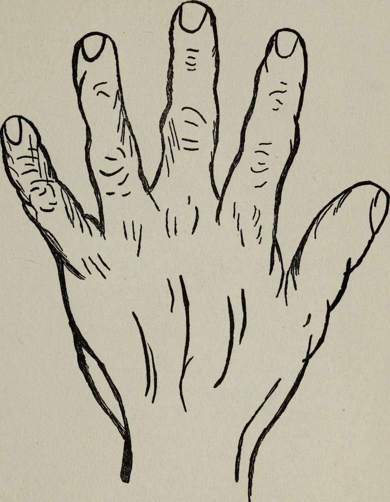 An illustration from Perin's science of palmistry; a complete and authentic treatise, 1902, leaf 34