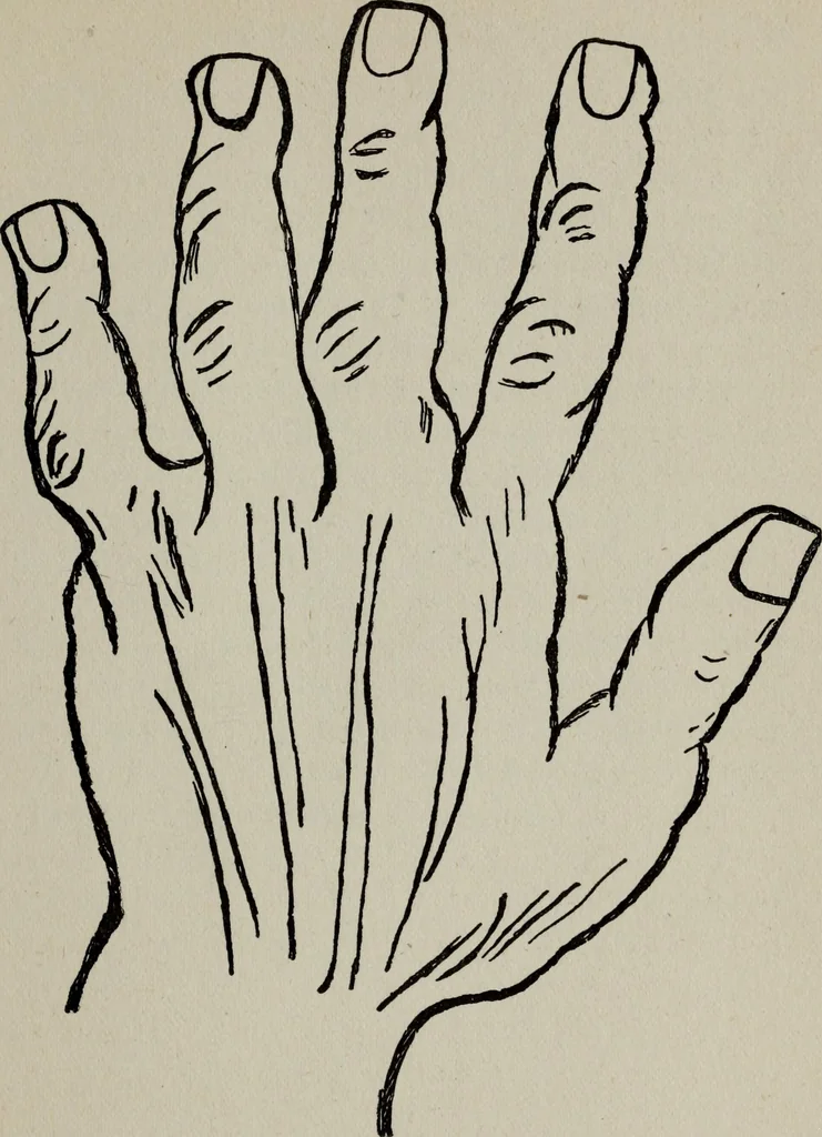 An illustration from Perin's science of palmistry; a complete and authentic treatise, 1902, leaf 42