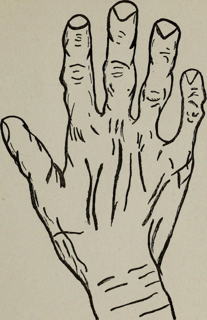An illustration from Perin's science of palmistry; a complete and authentic treatise, 1902, leaf 46