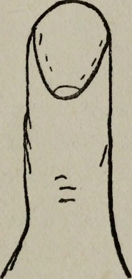 An illustration from Perin's science of palmistry; a complete and authentic treatise, 1902, leaf 76