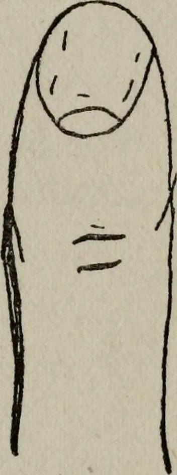 An illustration from Perin's science of palmistry; a complete and authentic treatise, 1902, leaf 76