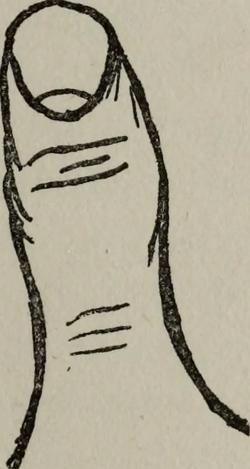 An illustration from Perin's science of palmistry; a complete and authentic treatise, 1902, leaf 82