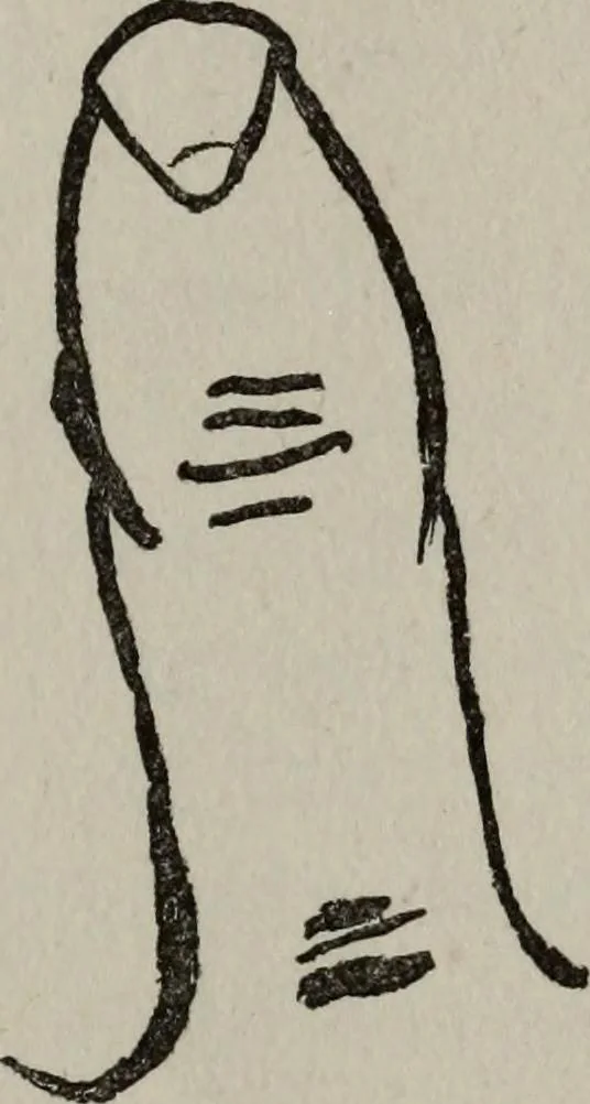 An illustration from Perin's science of palmistry; a complete and authentic treatise, 1902, leaf 82