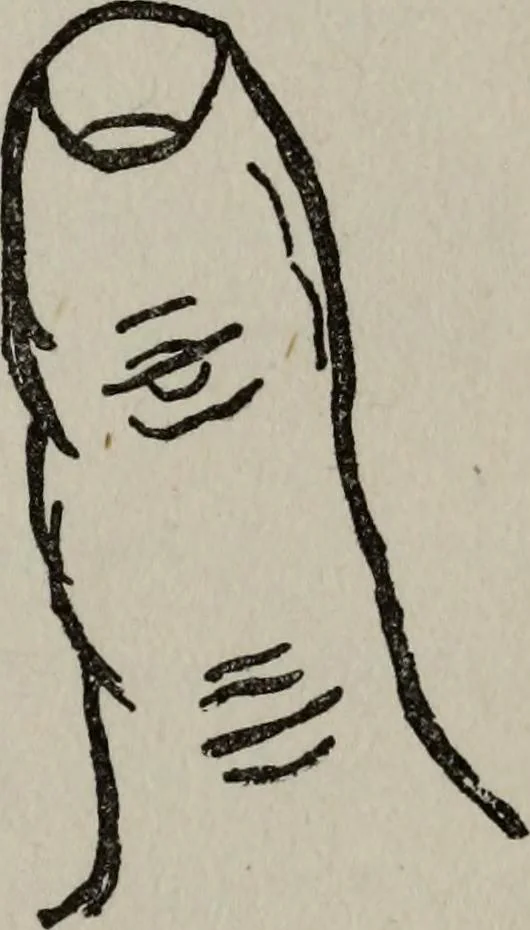 An illustration from Perin's science of palmistry; a complete and authentic treatise, 1902, leaf 82