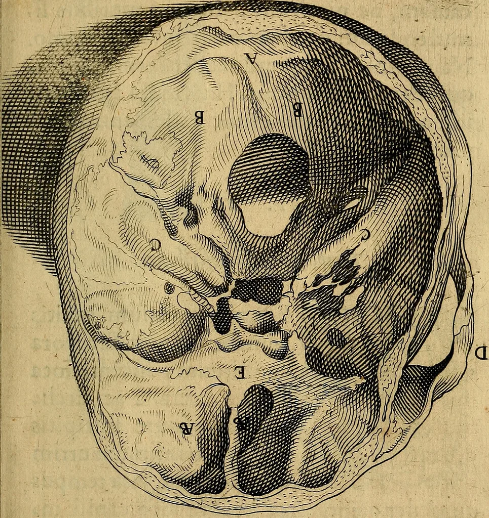 An illustration from Petri Paaw Amsteldamensis, in Academia Lugduno-Batava anatomici & botanici professoris Primitiae anatomicae : de humani corporis ossibus, 1615, leaf 72