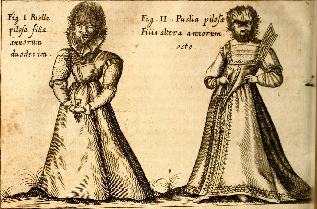 An illustration from P. Gasparis Schotti, regis curtani ... Physica curiosa, sive, Mirabilia naturæ et artis libris XII. comprehensa : quibus pleraq[ue], quæ de angelis, dæmonibus, hominibus, spectris, energumenis, monstris, portentis, animalibus, meteoris, &c. rara, arcana, curiosaq[ue] circumferuntur, ad veritatis trutinam expenduntur : variis ex historia ac philosophia petitis disquisitionibus excutiuntur, & innumeris exemplis illustrantur .., 1662, leaf 515
