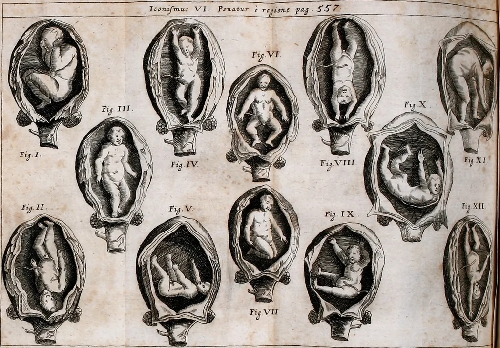 An illustration from P. Gasparis Schotti, regis curtani ... Physica curiosa, sive, Mirabilia naturæ et artis libris XII. comprehensa : quibus pleraq[ue], quæ de angelis, dæmonibus, hominibus, spectris, energumenis, monstris, portentis, animalibus, meteoris, &c. rara, arcana, curiosaq[ue] circumferuntur, ad veritatis trutinam expenduntur : variis ex historia ac philosophia petitis disquisitionibus excutiuntur, & innumeris exemplis illustrantur .., 1662, leaf 631