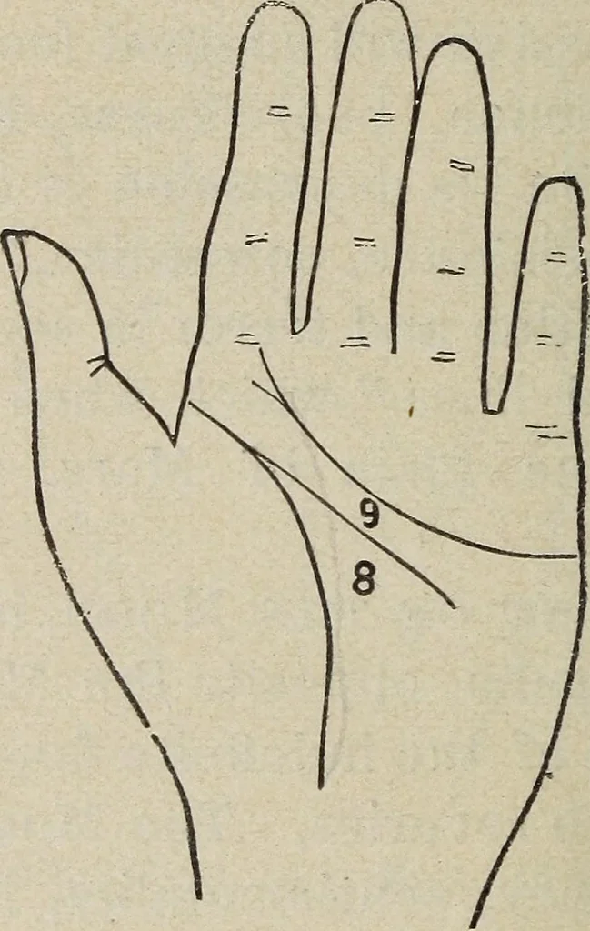An illustration from Philosophic chiromancy. Mysteries of the hand revealed and explained: the art of determining, from an inspection of the hands, the person's temperature, appetites, passions, impulses, aspirations, mental endowments, character and tendencies, 1879, leaf 115