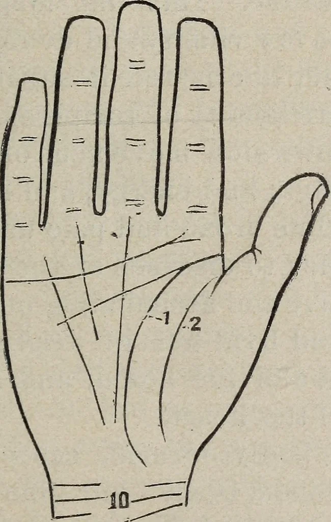 An illustration from Philosophic chiromancy. Mysteries of the hand revealed and explained: the art of determining, from an inspection of the hands, the person's temperature, appetites, passions, impulses, aspirations, mental endowments, character and tendencies, 1879, leaf 124