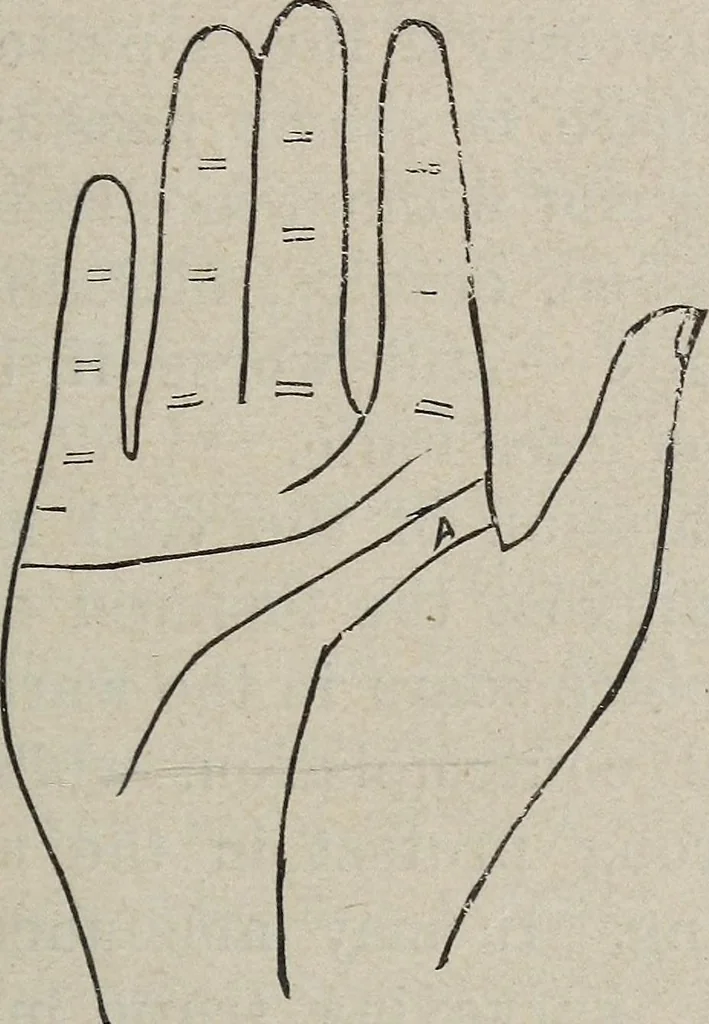 An illustration from Philosophic chiromancy. Mysteries of the hand revealed and explained: the art of determining, from an inspection of the hands, the person's temperature, appetites, passions, impulses, aspirations, mental endowments, character and tendencies, 1879, leaf 132