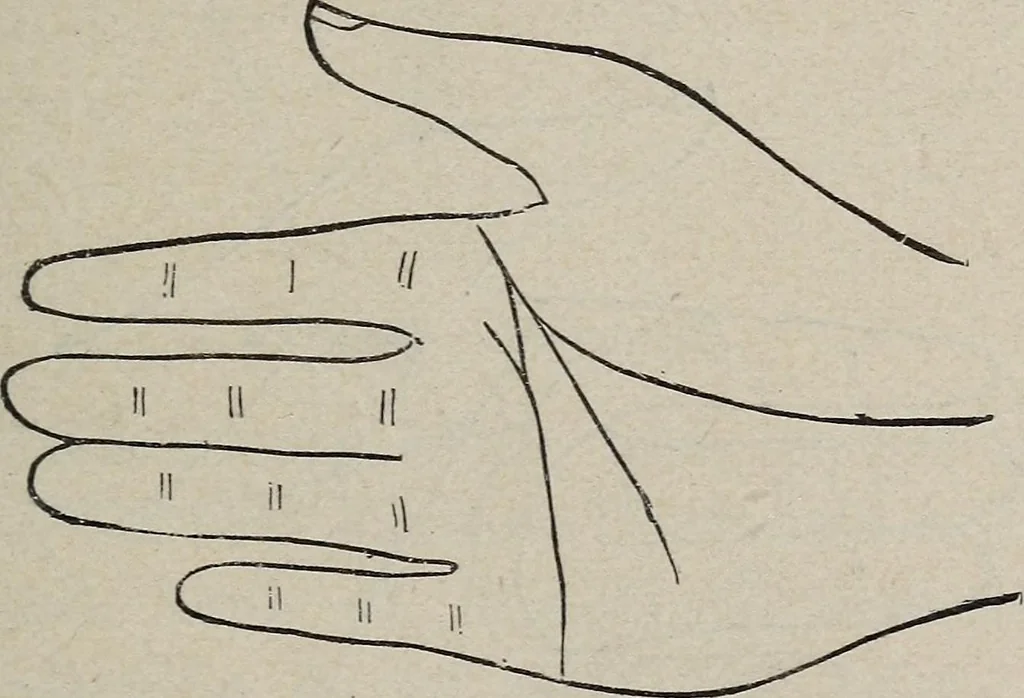 An illustration from Philosophic chiromancy. Mysteries of the hand revealed and explained: the art of determining, from an inspection of the hands, the person's temperature, appetites, passions, impulses, aspirations, mental endowments, character and tendencies, 1879, leaf 136