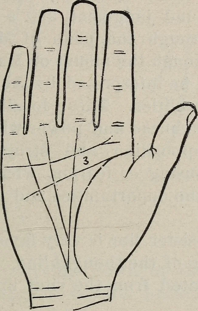 An illustration from Philosophic chiromancy. Mysteries of the hand revealed and explained: the art of determining, from an inspection of the hands, the person's temperature, appetites, passions, impulses, aspirations, mental endowments, character and tendencies, 1879, leaf 138