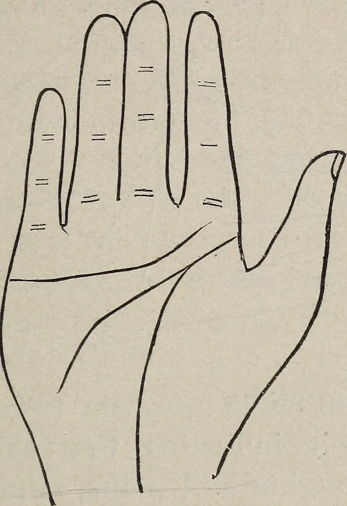 An illustration from Philosophic chiromancy. Mysteries of the hand revealed and explained: the art of determining, from an inspection of the hands, the person's temperature, appetites, passions, impulses, aspirations, mental endowments, character and tendencies, 1879, leaf 140