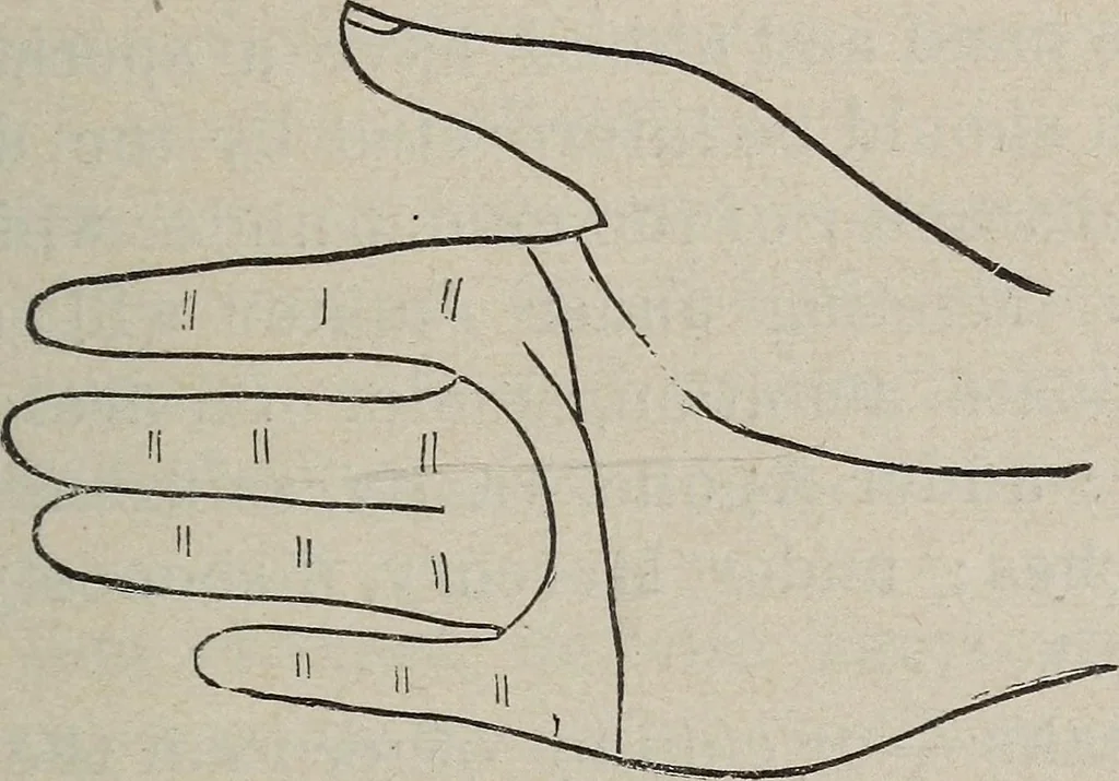 An illustration from Philosophic chiromancy. Mysteries of the hand revealed and explained: the art of determining, from an inspection of the hands, the person's temperature, appetites, passions, impulses, aspirations, mental endowments, character and tendencies, 1879, leaf 146