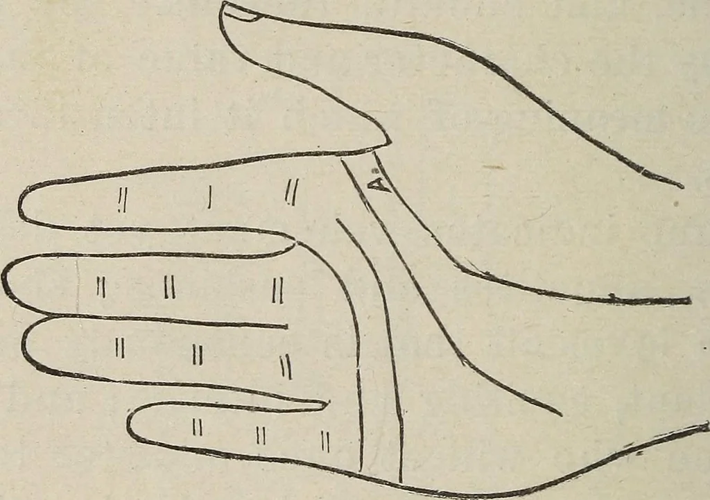 An illustration from Philosophic chiromancy. Mysteries of the hand revealed and explained: the art of determining, from an inspection of the hands, the person's temperature, appetites, passions, impulses, aspirations, mental endowments, character and tendencies, 1879, leaf 151