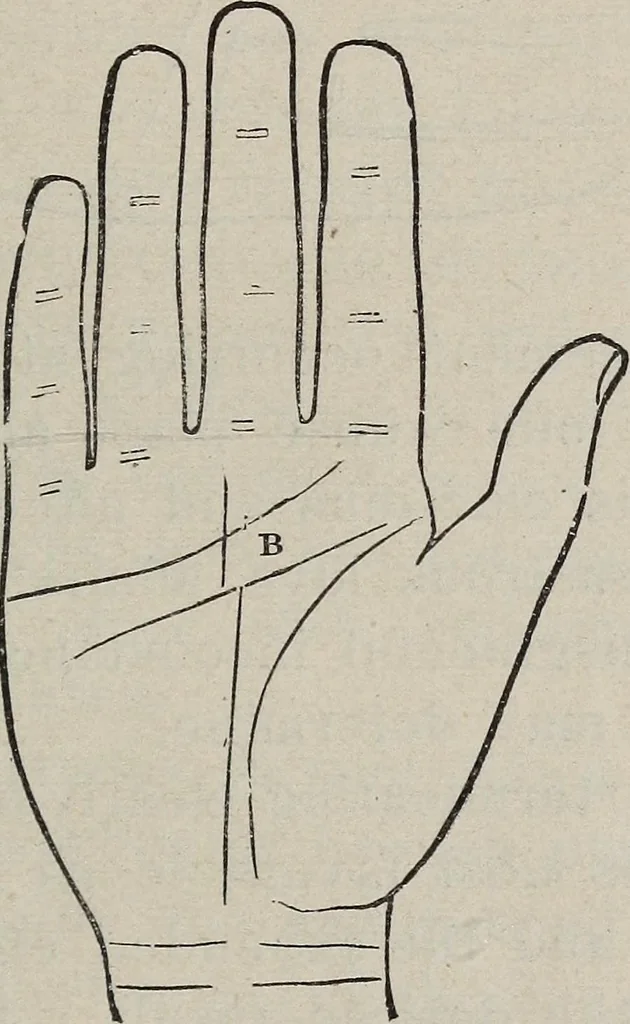 An illustration from Philosophic chiromancy. Mysteries of the hand revealed and explained: the art of determining, from an inspection of the hands, the person's temperature, appetites, passions, impulses, aspirations, mental endowments, character and tendencies, 1879, leaf 156