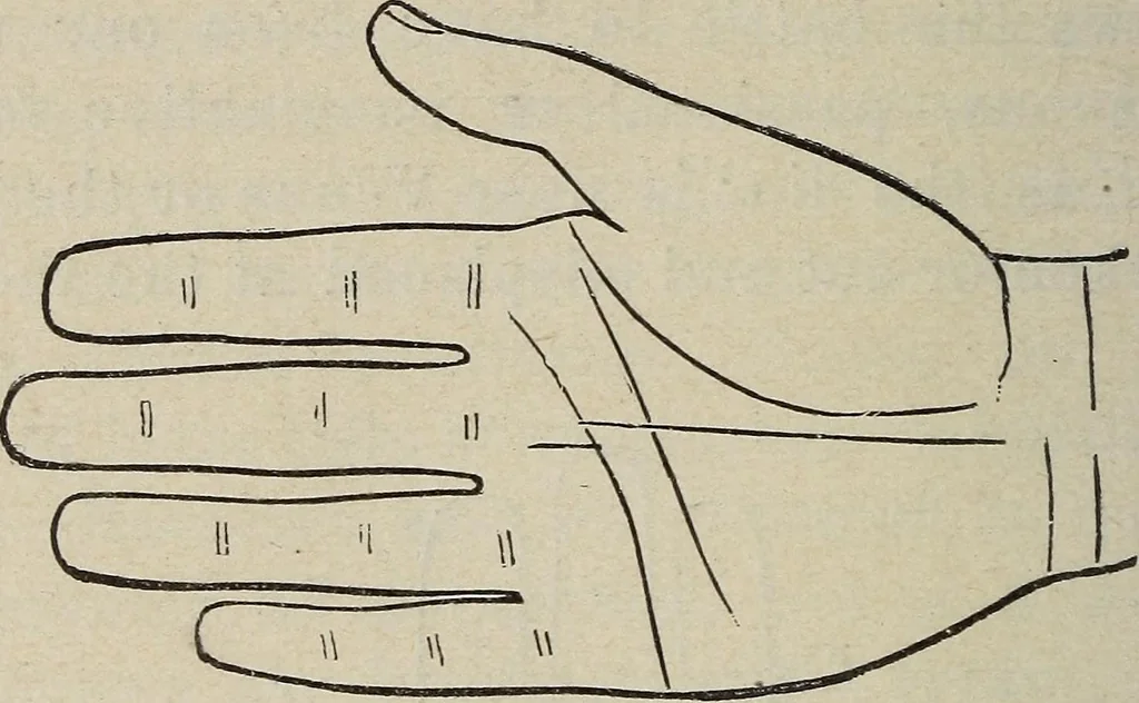 An illustration from Philosophic chiromancy. Mysteries of the hand revealed and explained: the art of determining, from an inspection of the hands, the person's temperature, appetites, passions, impulses, aspirations, mental endowments, character and tendencies, 1879, leaf 157