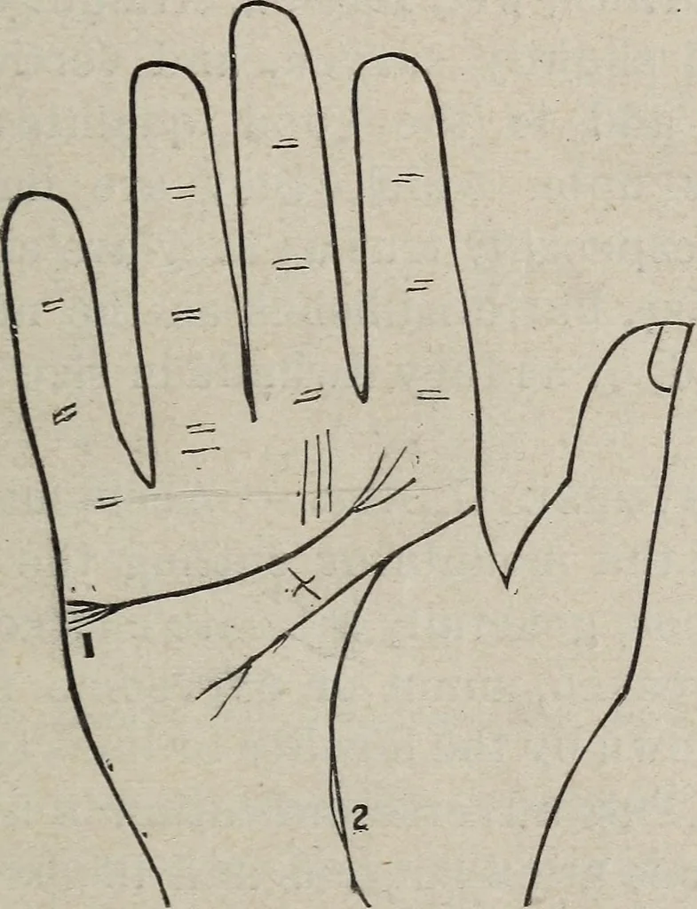 An illustration from Philosophic chiromancy. Mysteries of the hand revealed and explained: the art of determining, from an inspection of the hands, the person's temperature, appetites, passions, impulses, aspirations, mental endowments, character and tendencies, 1879, leaf 168