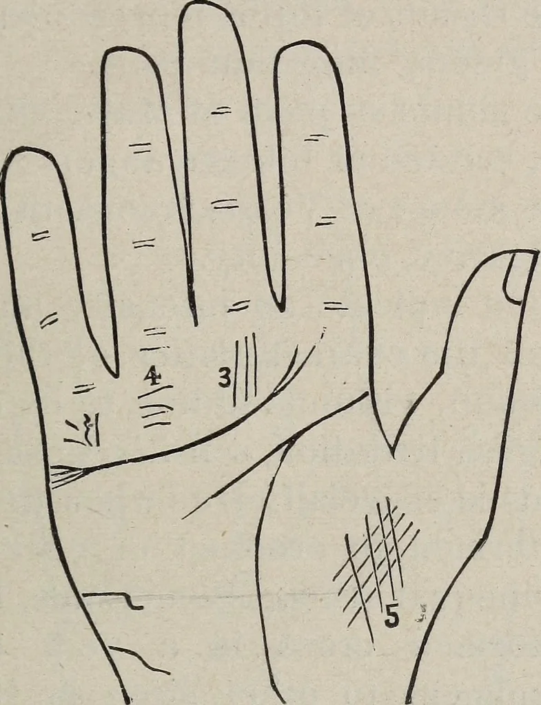 An illustration from Philosophic chiromancy. Mysteries of the hand revealed and explained: the art of determining, from an inspection of the hands, the person's temperature, appetites, passions, impulses, aspirations, mental endowments, character and tendencies, 1879, leaf 170