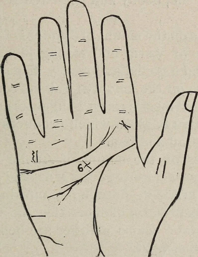 An illustration from Philosophic chiromancy. Mysteries of the hand revealed and explained: the art of determining, from an inspection of the hands, the person's temperature, appetites, passions, impulses, aspirations, mental endowments, character and tendencies, 1879, leaf 172