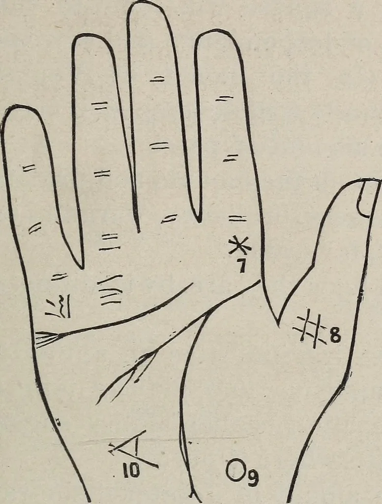 An illustration from Philosophic chiromancy. Mysteries of the hand revealed and explained: the art of determining, from an inspection of the hands, the person's temperature, appetites, passions, impulses, aspirations, mental endowments, character and tendencies, 1879, leaf 174