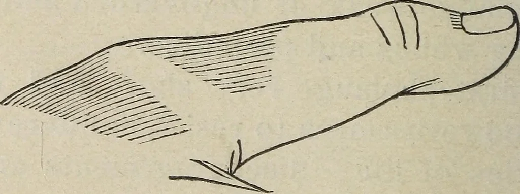 An illustration from Philosophic chiromancy. Mysteries of the hand revealed and explained: the art of determining, from an inspection of the hands, the person's temperature, appetites, passions, impulses, aspirations, mental endowments, character and tendencies, 1879, leaf 67